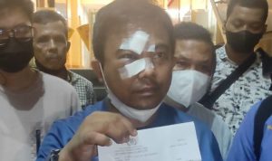 Ketua Umum Komite Nasional Pemuda Indonesia (KNPI) Haris Pertama